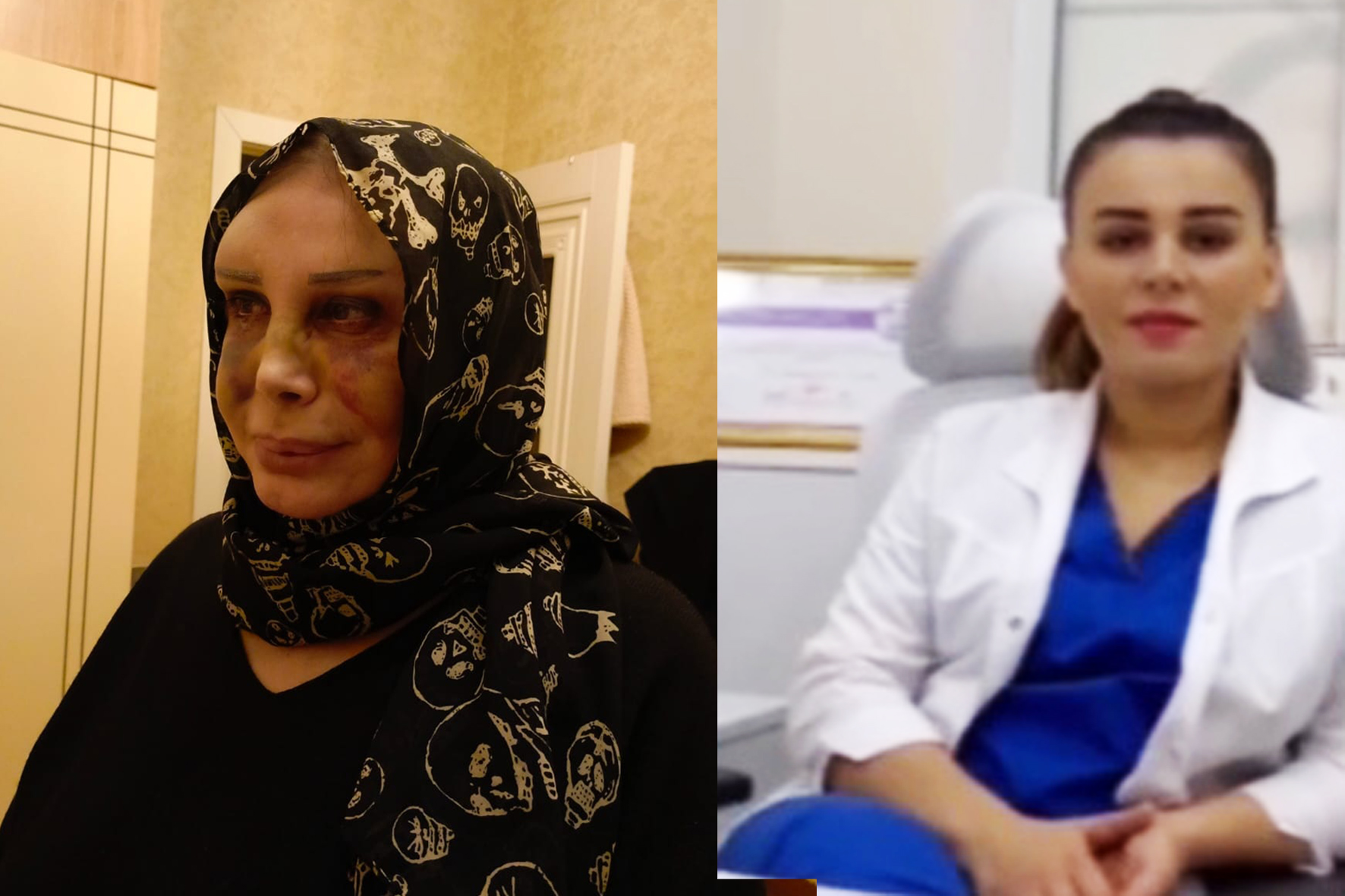 Sağlamlıqla oynayanlar, Susdurulan zərərçəkən və şübhə doğuran qərar: Prokurorluq nəyi gizlədir? FOTO/VİDEO