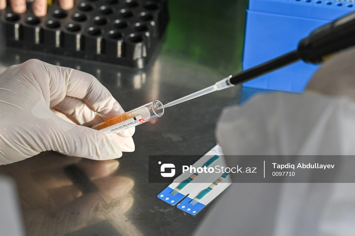 Azərbaycanda Nipah virusuna yoluxma halları var? - RƏSMİ