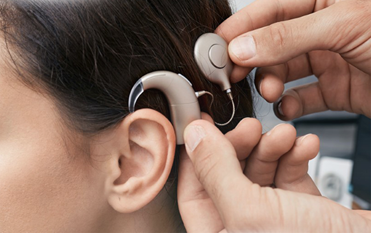 Üst cihazın əvəzlənməsi və yenilənməsi icbari tibbi sığorta ilə qarşılanır