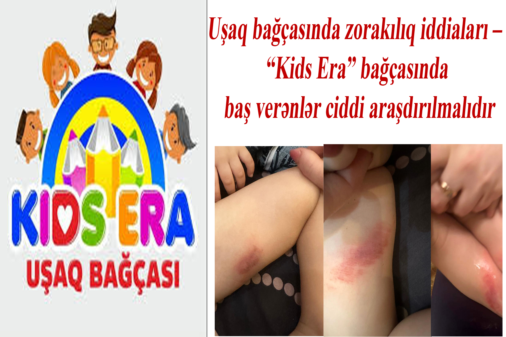 Uşaq bağçasında zorakılıq iddiaları – “Kids Era” bağçasında baş verənlər ciddi araşdırılmalıdır