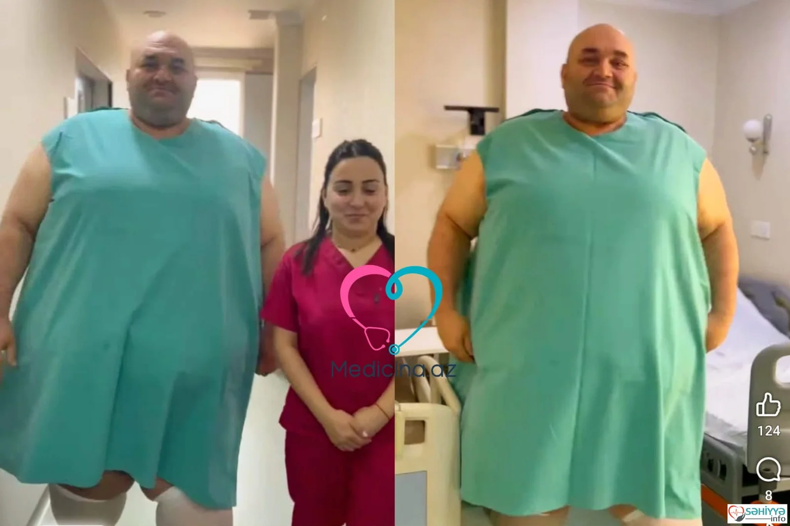 Azərbaycanda 330 kq çəkili kişi əməliyyat olundu