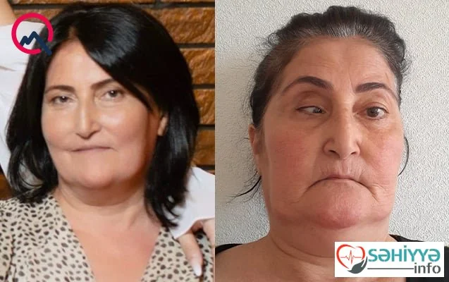 Liman klinikası təzminat ödəyəcək
